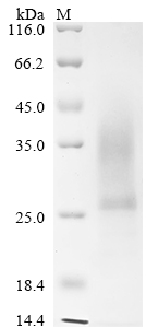 (Tris-Glycine gel) Discontinuous SDS-PAGE (reduced) with 5% enrichment gel and 15% separation gel. (Tris-Glycine gel) Discontinuous SDS-PAGE (reduced) with 5% enrichment gel and 15% separation gel.