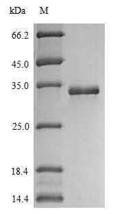 (Tris-Glycine gel) Discontinuous SDS-PAGE (reduced) with 5% enrichment gel and 15% separation gel. (Tris-Glycine gel) Discontinuous SDS-PAGE (reduced) with 5% enrichment gel and 15% separation gel.