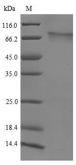 (Tris-Glycine gel) Discontinuous SDS-PAGE (reduced) with 5% enrichment gel and 15% separation gel. (Tris-Glycine gel) Discontinuous SDS-PAGE (reduced) with 5% enrichment gel and 15% separation gel.