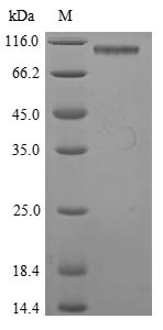 (Tris-Glycine gel) Discontinuous SDS-PAGE (reduced) with 5% enrichment gel and 15% separation gel. (Tris-Glycine gel) Discontinuous SDS-PAGE (reduced) with 5% enrichment gel and 15% separation gel.
