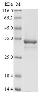 (Tris-Glycine gel) Discontinuous SDS-PAGE (reduced) with 5% enrichment gel and 15% separation gel. (Tris-Glycine gel) Discontinuous SDS-PAGE (reduced) with 5% enrichment gel and 15% separation gel.