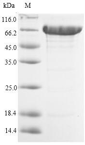(Tris-Glycine gel) Discontinuous SDS-PAGE (reduced) with 5% enrichment gel and 15% separation gel. (Tris-Glycine gel) Discontinuous SDS-PAGE (reduced) with 5% enrichment gel and 15% separation gel.