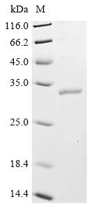 Recombinant Human CCR4-NOT transcription complex subunit 7 (CNOT7) - image 1