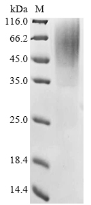 Recombinant Mouse Reticulon-3 (Rtn3) , partial - image 1