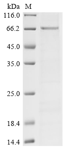 Recombinant Human SET and MYND domain-containing protein 3 (SMYD3) - image 1