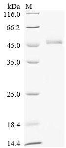 Recombinant Human O-phosphoseryl-tRNA (Sec) selenium transferase (SEPSECS) - image 1