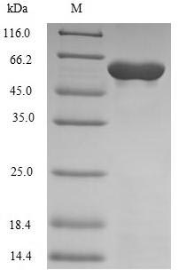 (Tris-Glycine gel) Discontinuous SDS-PAGE (reduced) with 5% enrichment gel and 15% separation gel. (Tris-Glycine gel) Discontinuous SDS-PAGE (reduced) with 5% enrichment gel and 15% separation gel.
