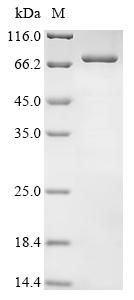 Recombinant Human Interferon kappa (IFNK) - image 1