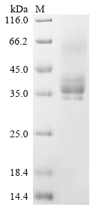 Recombinant Human Methyl-CpG-binding domain protein 2 (MBD2) , partial - image 1