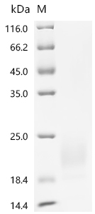 (Tris-Glycine gel) Discontinuous SDS-PAGE (reduced) with 5% enrichment gel and 15% separation gel. (Tris-Glycine gel) Discontinuous SDS-PAGE (reduced) with 5% enrichment gel and 15% separation gel.