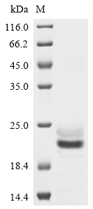 Recombinant Human E3 ubiquitin-protein ligase ZNRF3 (ZNRF3) , partial - image 1