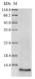 (Tris-Glycine gel) Discontinuous SDS-PAGE (reduced) with 5% enrichment gel and 15% separation gel. (Tris-Glycine gel) Discontinuous SDS-PAGE (reduced) with 5% enrichment gel and 15% separation gel.