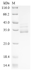 (Tris-Glycine gel) Discontinuous SDS-PAGE (reduced) with 5% enrichment gel and 15% separation gel.