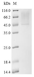 Recombinant Human Sialidase-2 (NEU2) - image 1