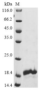Recombinant Human Neuron navigator 1 (NAV1) , partial - image 1