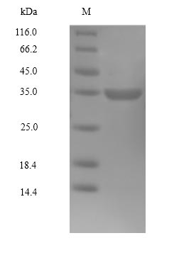 (Tris-Glycine gel) Discontinuous SDS-PAGE (reduced) with 5% enrichment gel and 15% separation gel. (Tris-Glycine gel) Discontinuous SDS-PAGE (reduced) with 5% enrichment gel and 15% separation gel.