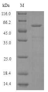 (Tris-Glycine gel) Discontinuous SDS-PAGE (reduced) with 5% enrichment gel and 15% separation gel. (Tris-Glycine gel) Discontinuous SDS-PAGE (reduced) with 5% enrichment gel and 15% separation gel.