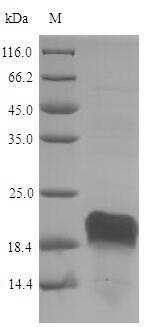 SDS-PAGE- Recombinant protein Pig HSP90AA1