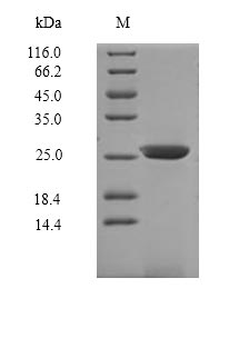 (Tris-Glycine gel) Discontinuous SDS-PAGE (reduced) with 5% enrichment gel and 15% separation gel. (Tris-Glycine gel) Discontinuous SDS-PAGE (reduced) with 5% enrichment gel and 15% separation gel.