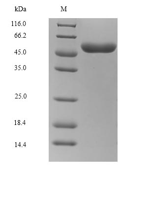 (Tris-Glycine gel) Discontinuous SDS-PAGE (reduced) with 5% enrichment gel and 15% separation gel. (Tris-Glycine gel) Discontinuous SDS-PAGE (reduced) with 5% enrichment gel and 15% separation gel.