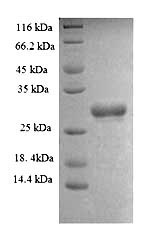 (Tris-Glycine gel) Discontinuous SDS-PAGE (reduced) with 5% enrichment gel and 15% separation gel. (Tris-Glycine gel) Discontinuous SDS-PAGE (reduced) with 5% enrichment gel and 15% separation gel.