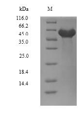 SDS-PAGE- Recombinant protein Human DYRK2
