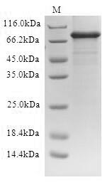 SDS-PAGE- Recombinant protein Human ABCD1