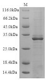 SDS-PAGE- Recombinant protein Human CD19