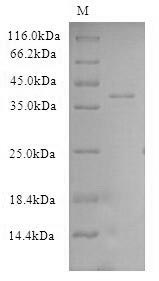 (Tris-Glycine gel) Discontinuous SDS-PAGE (reduced) with 5% enrichment gel and 15% separation gel. (Tris-Glycine gel) Discontinuous SDS-PAGE (reduced) with 5% enrichment gel and 15% separation gel.