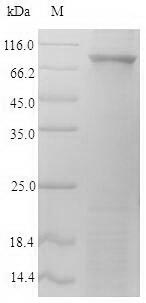 (Tris-Glycine gel) Discontinuous SDS-PAGE (reduced) with 5% enrichment gel and 15% separation gel. (Tris-Glycine gel) Discontinuous SDS-PAGE (reduced) with 5% enrichment gel and 15% separation gel.