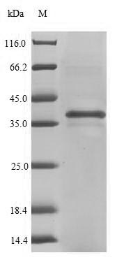 (Tris-Glycine gel) Discontinuous SDS-PAGE (reduced) with 5% enrichment gel and 15% separation gel. (Tris-Glycine gel) Discontinuous SDS-PAGE (reduced) with 5% enrichment gel and 15% separation gel.