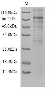 (Tris-Glycine gel) Discontinuous SDS-PAGE (reduced) with 5% enrichment gel and 15% separation gel. (Tris-Glycine gel) Discontinuous SDS-PAGE (reduced) with 5% enrichment gel and 15% separation gel.