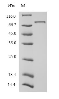 (Tris-Glycine gel) Discontinuous SDS-PAGE (reduced) with 5% enrichment gel and 15% separation gel. (Tris-Glycine gel) Discontinuous SDS-PAGE (reduced) with 5% enrichment gel and 15% separation gel.