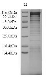 (Tris-Glycine gel) Discontinuous SDS-PAGE (reduced) with 5% enrichment gel and 15% separation gel. (Tris-Glycine gel) Discontinuous SDS-PAGE (reduced) with 5% enrichment gel and 15% separation gel.