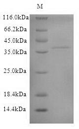 SDS-PAGE - Recombinant Dog Anionic trypsin