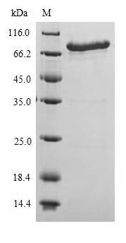 SDS-PAGE- Recombinant protein Escherichia mcr-1