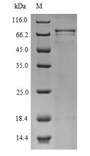 (Tris-Glycine gel) Discontinuous SDS-PAGE (reduced) with 5% enrichment gel and 15% separation gel. (Tris-Glycine gel) Discontinuous SDS-PAGE (reduced) with 5% enrichment gel and 15% separation gel.