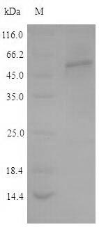 (Tris-Glycine gel) Discontinuous SDS-PAGE (reduced) with 5% enrichment gel and 15% separation gel. (Tris-Glycine gel) Discontinuous SDS-PAGE (reduced) with 5% enrichment gel and 15% separation gel.