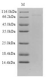 (Tris-Glycine gel) Discontinuous SDS-PAGE (reduced) with 5% enrichment gel and 15% separation gel. (Tris-Glycine gel) Discontinuous SDS-PAGE (reduced) with 5% enrichment gel and 15% separation gel.
