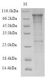 (Tris-Glycine gel) Discontinuous SDS-PAGE (reduced) with 5% enrichment gel and 15% separation gel. (Tris-Glycine gel) Discontinuous SDS-PAGE (reduced) with 5% enrichment gel and 15% separation gel.