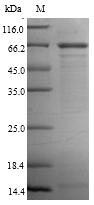 (Tris-Glycine gel) Discontinuous SDS-PAGE (reduced) with 5% enrichment gel and 15% separation gel. (Tris-Glycine gel) Discontinuous SDS-PAGE (reduced) with 5% enrichment gel and 15% separation gel.