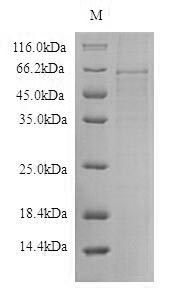(Tris-Glycine gel) Discontinuous SDS-PAGE (reduced) with 5% enrichment gel and 15% separation gel. (Tris-Glycine gel) Discontinuous SDS-PAGE (reduced) with 5% enrichment gel and 15% separation gel.