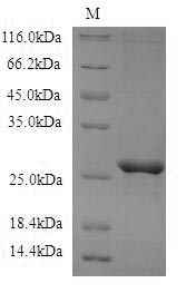 (Tris-Glycine gel) Discontinuous SDS-PAGE (reduced) with 5% enrichment gel and 15% separation gel. (Tris-Glycine gel) Discontinuous SDS-PAGE (reduced) with 5% enrichment gel and 15% separation gel.