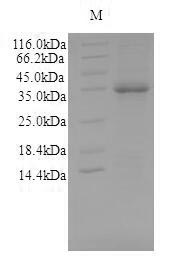 (Tris-Glycine gel) Discontinuous SDS-PAGE (reduced) with 5% enrichment gel and 15% separation gel. (Tris-Glycine gel) Discontinuous SDS-PAGE (reduced) with 5% enrichment gel and 15% separation gel.
