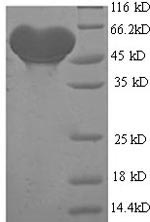 SDS-PAGE- Recombinant protein Human ADH1B