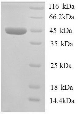 (Tris-Glycine gel) Discontinuous SDS-PAGE (reduced) with 5% enrichment gel and 15% separation gel. (Tris-Glycine gel) Discontinuous SDS-PAGE (reduced) with 5% enrichment gel and 15% separation gel.