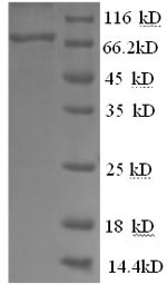 (Tris-Glycine gel) Discontinuous SDS-PAGE (reduced) with 5% enrichment gel and 15% separation gel. (Tris-Glycine gel) Discontinuous SDS-PAGE (reduced) with 5% enrichment gel and 15% separation gel.