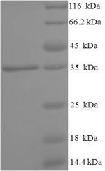 SDS-PAGE- Recombinant protein Human 4