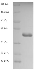 (Tris-Glycine gel) Discontinuous SDS-PAGE (reduced) with 5% enrichment gel and 15% separation gel. (Tris-Glycine gel) Discontinuous SDS-PAGE (reduced) with 5% enrichment gel and 15% separation gel.