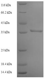 (Tris-Glycine gel) Discontinuous SDS-PAGE (reduced) with 5% enrichment gel and 15% separation gel.
